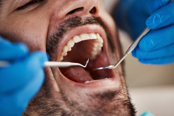 Best Full Mouth Reconstruction  in Romancoke, MD